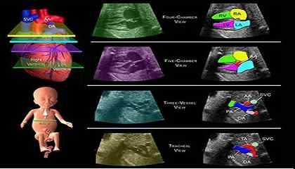 تمامی سونوگرافی‌های دوران بارداری و اکو قلب جنین 