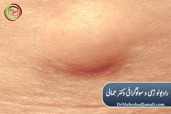 سونوگرافی نسج نرم 