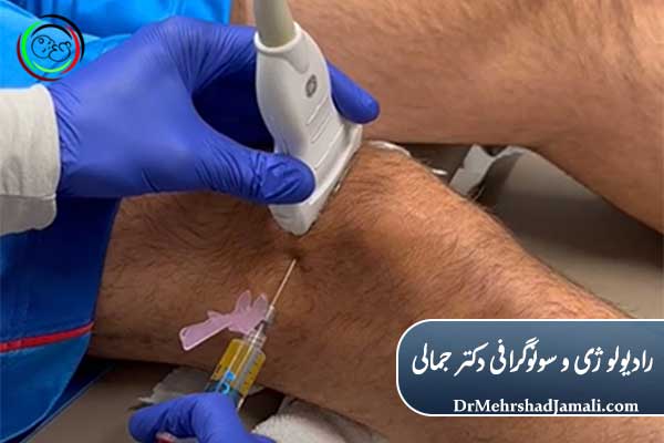 مزیت تزریق با هدایت سونوگرافی