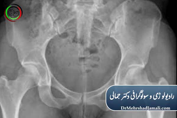 رادیولوژی در سرطان‌شناسی