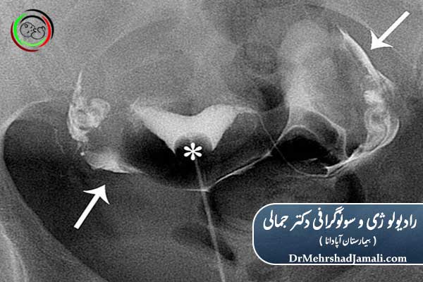 هزینه عکس رنگی رحم