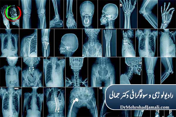 رادیولوژی در تشخیص بیماری‌های قفسه سینه