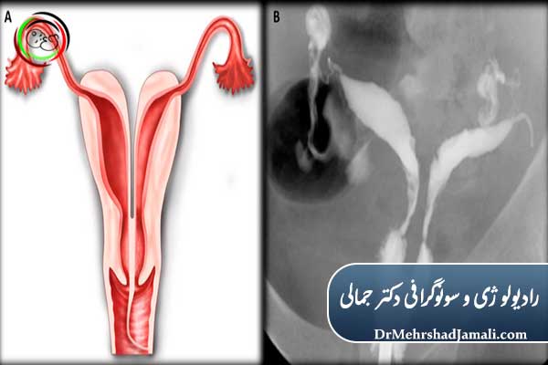 بهترین زمان برای انجام عکس رنگی رحم