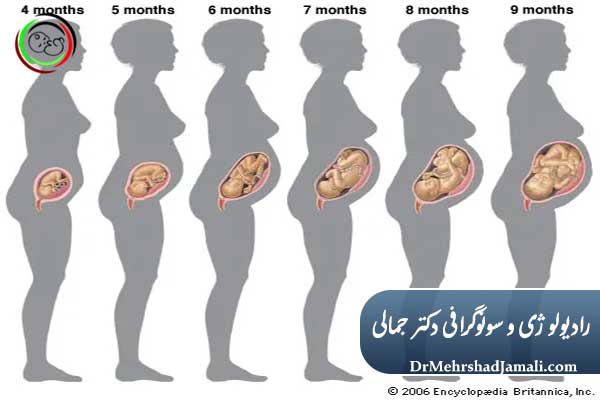  سن بارداری در هر سه‌ماهه چگونه است؟