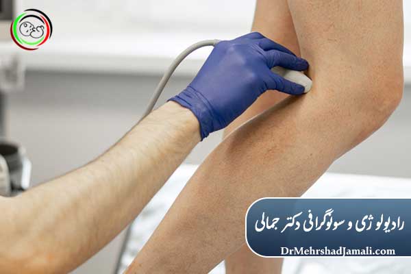 سونوگرافی واریس چگونه انجام میشود؟