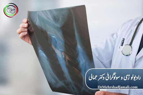 نقش رادیولوژی در تشخیص آمبولی ریه