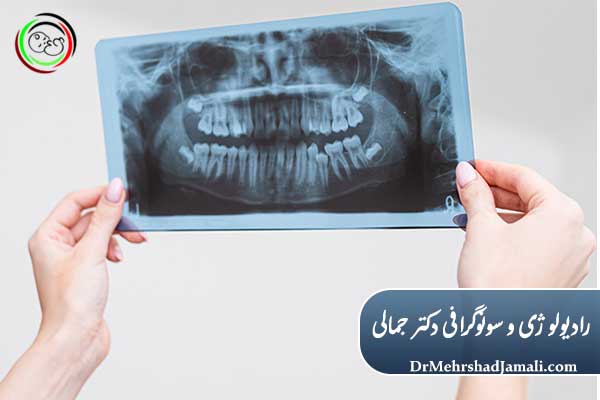 کاربرد تفسیر عکس رادیولوژی دندان در درمان‌های مختلف