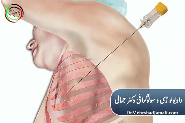 مزایای نمونه‌برداری هدایت‌شده