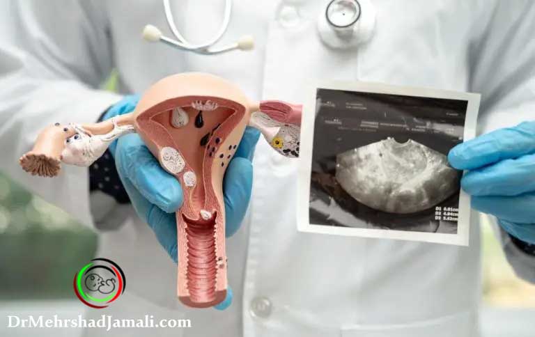 خدمات تخصصی سونوگرافی کیست تخمدان در مرکز دکتر مهرشاد جمالی