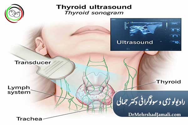 فرایند انجام سونوگرافی تیروئید