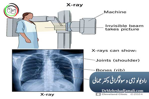 آیا رادیولوژی برای بدن ضرر دارد؟
