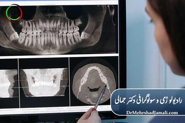 مراحل تفسیر عکس دندان