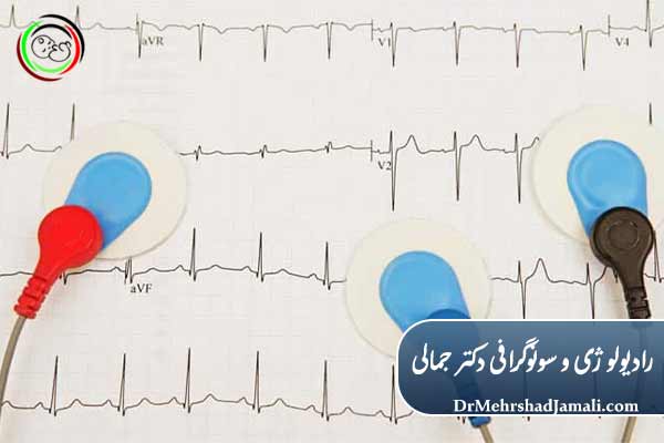 نوار قلب (ECG)