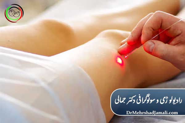 بهترین روشهای غیرجراحی درمان واریس