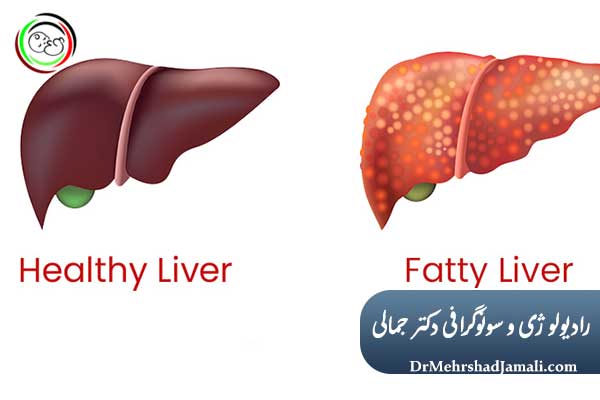https://drmehrshadjamali.com/post?PId=39/%D9%86%D9%85%D9%88%D9%86%D9%87-%D8%A8%D8%B1%D8%AF%D8%A7%D8%B1%DB%8C-%DB%8C%D8%A7-%D8%A8%DB%8C%D9%88%D9%BE%D8%B3%DB%8C-%DA%86%DB%8C%D8%B3%D8%AA%D8%9F