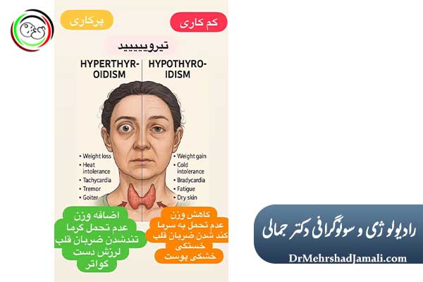 مهمترین علائم پرکاری تیروئید