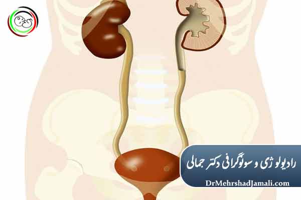 آمادگی قبل از انجام VCUG