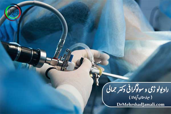 مراحل انجام عکس رنگی رحم