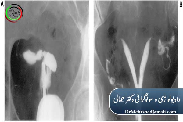 آیا عکس رنگی رحم درد دارد؟