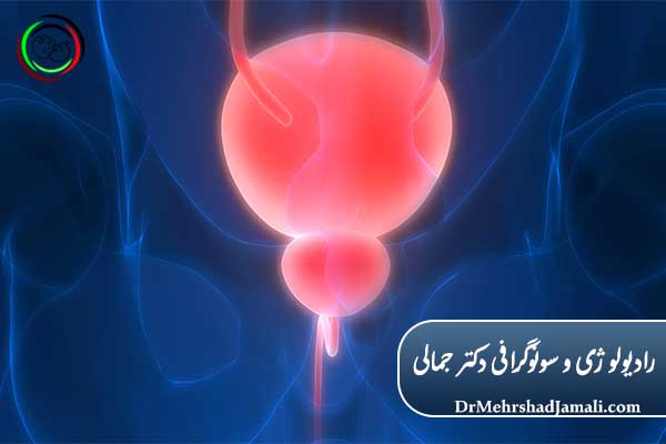 VCUG چگونه انجام می‌شود؟ (مراحل انجام)