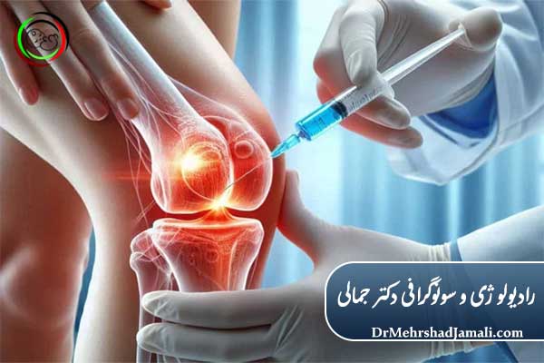 هزینه تزریق PRP و ژل