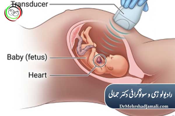 بهترین زمان انجام اکو قلب جنین