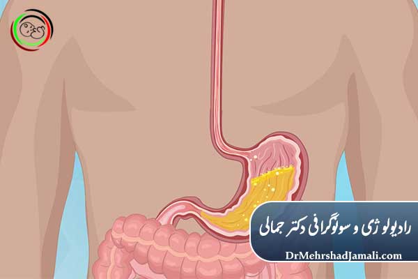 مهم‌ترین آمادگی قبل از عکس رنگی معده