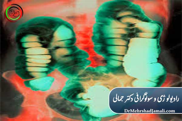 عکس رنگی دستگاه گوارش چیست؟