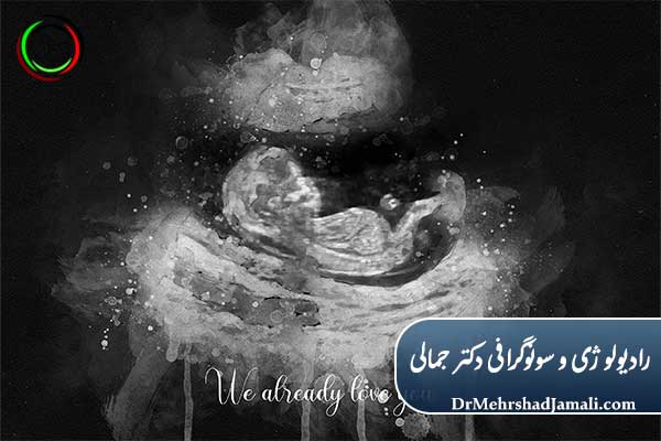 زودترین زمان تعیین جنسیت جنین