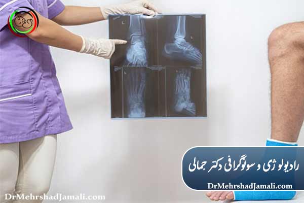 رادیولوژی در تشخیص بیماری‌های استخوان و مفاصل