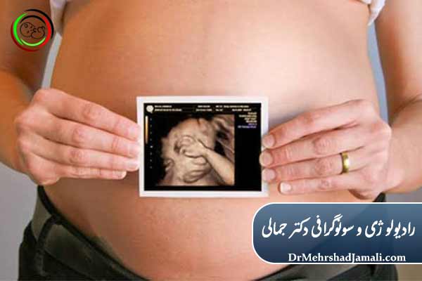 آیا سونوگرافی سه بعدی و چهار بعدی آب دور جنین را جوش میآورد؟
