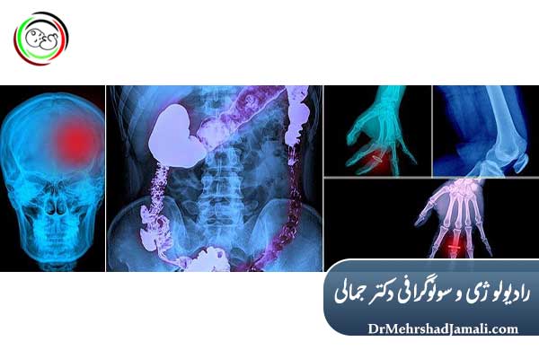 تفاوت رادیولوژی با سایر روش های تصویر برداری