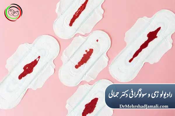 آیا لکه‌بینی همیشه نیاز به درمان دارد؟