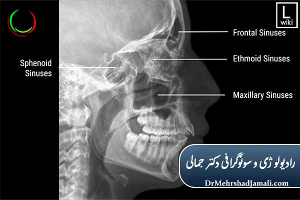 انواع نماهای عکس سینوس