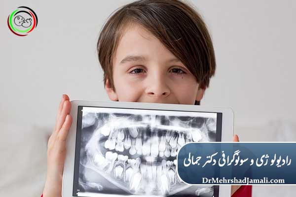 آیا اشعه روی رشد کودک اثر دارد؟