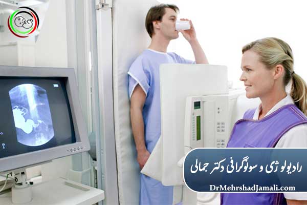 چگونگی انجام بلع باریم