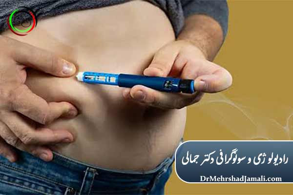کاهش وزن با آمپول و مشکلات تیروئید