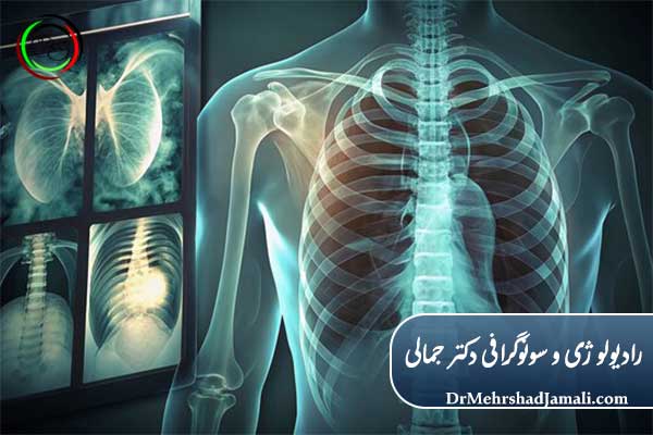 مراحل انجام عکس قفسه سینه برای ویزا