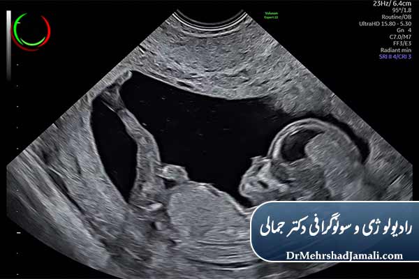 چرا دقت در اندازهگیری HC چنین اهمیتی دارد؟