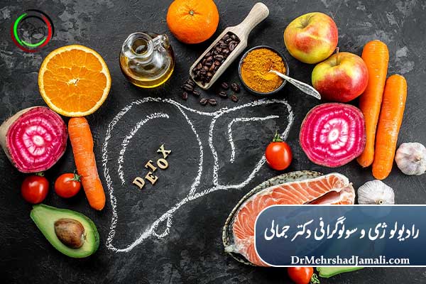 درمان کبد چرب