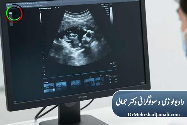 چه زمانی باید نگران نتیجه سونوگرافی بود؟