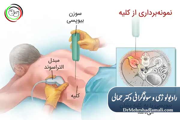 مراحل انجام نمونه‌برداری