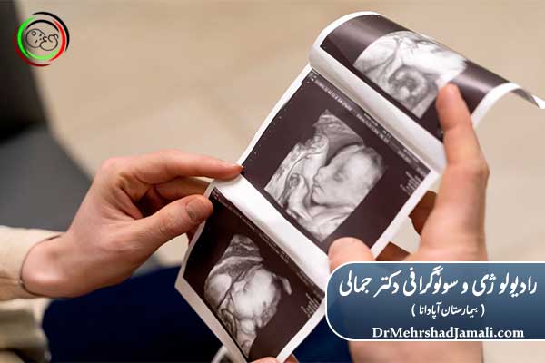 مقایسه غربالگری با سایر سونوگرافی‌ها