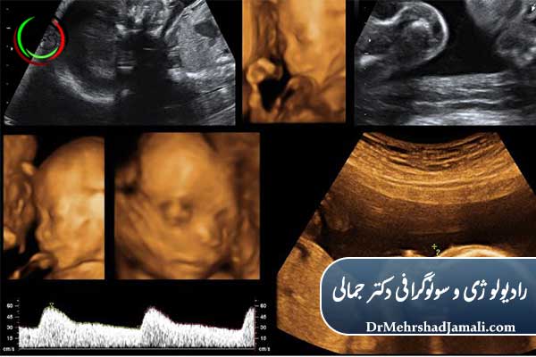 آنومالی اسکن چیست؟