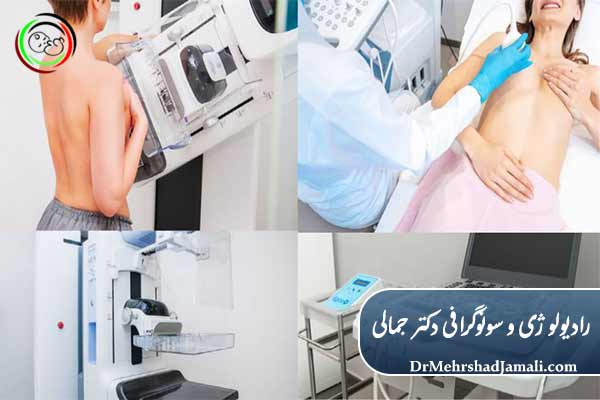 تفاوت ماموگرافی و سونوگرافی 