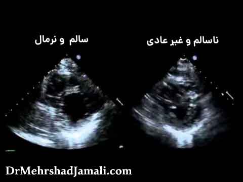 جواب سونوگرافی قلب و عروق