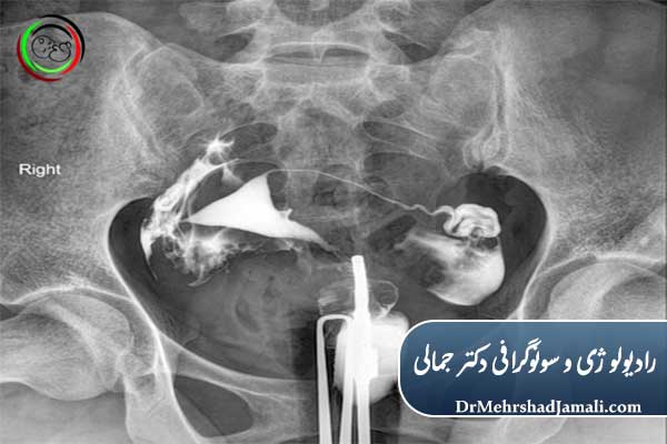 مراقبت‌های بلافاصله قبل از انجام عکس رنگی رحم