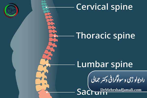 رادیولوژی ستون فقرات