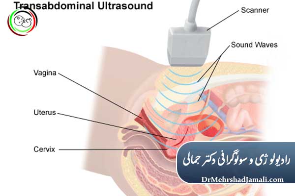 تفاوت سونوگرافی ترانس‌ابدومینال با ترانس‌واژینال