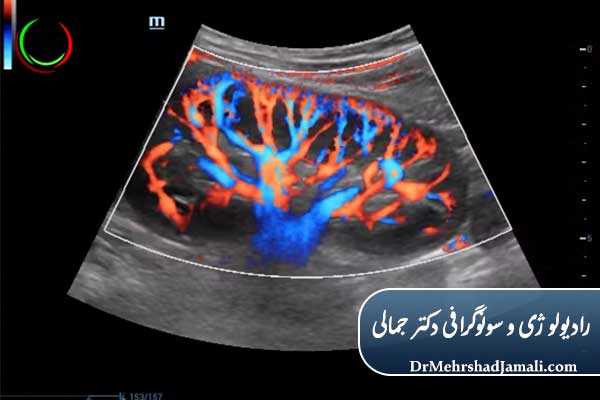 مزایای سونوگرافی داپلر